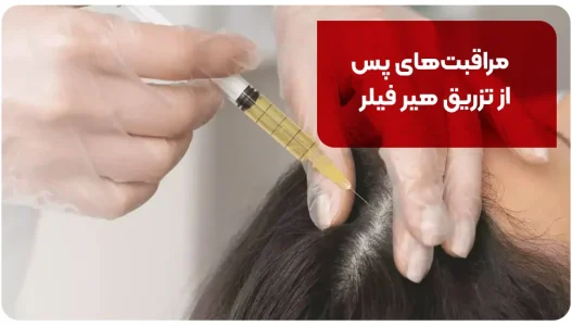 مراقبتهای پس از تزریق هیر فیلر