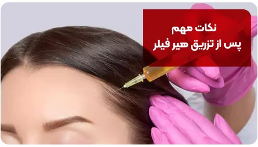 نکات مهم پس از تزریق هیر فیلر
