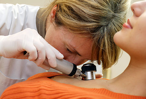 عکس سرطان پوست,ارزیابی خال PRinc_photo_of_dermatologist_screening_for_melanoma