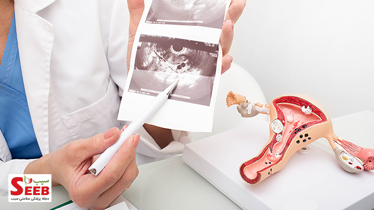 معنی ovary در سونوگرافی