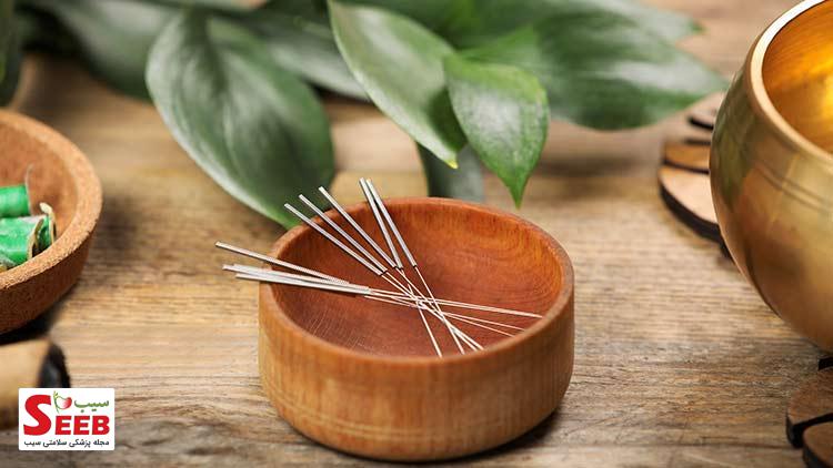 acupuncture طب سوزنی