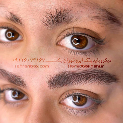 میکروبلیدینگ ابرو در کامرانیه