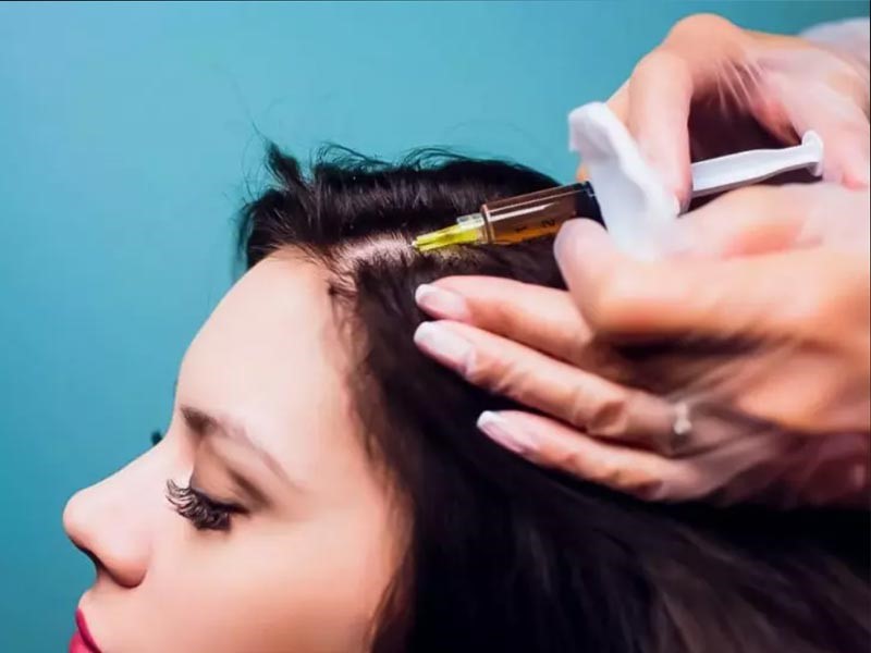 The best hair loss treatment supplements