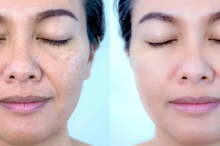 The best face whitening cream for oily skin