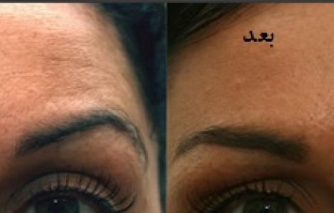 انواع راهکارهای از بین بردن چروک