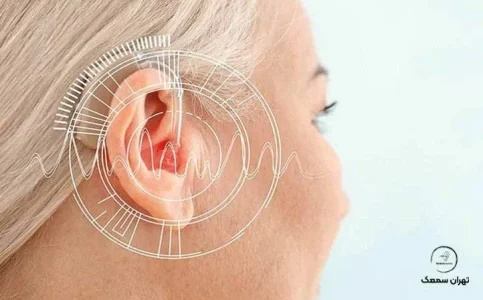 معرفی بهترین مرکز خرید سمعک - تهران سمعک