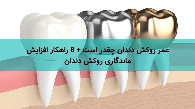 عمر روکش دندان چقدر است + 8 راهکار افزایش ماندگاری روکش دندان مجله سلامت