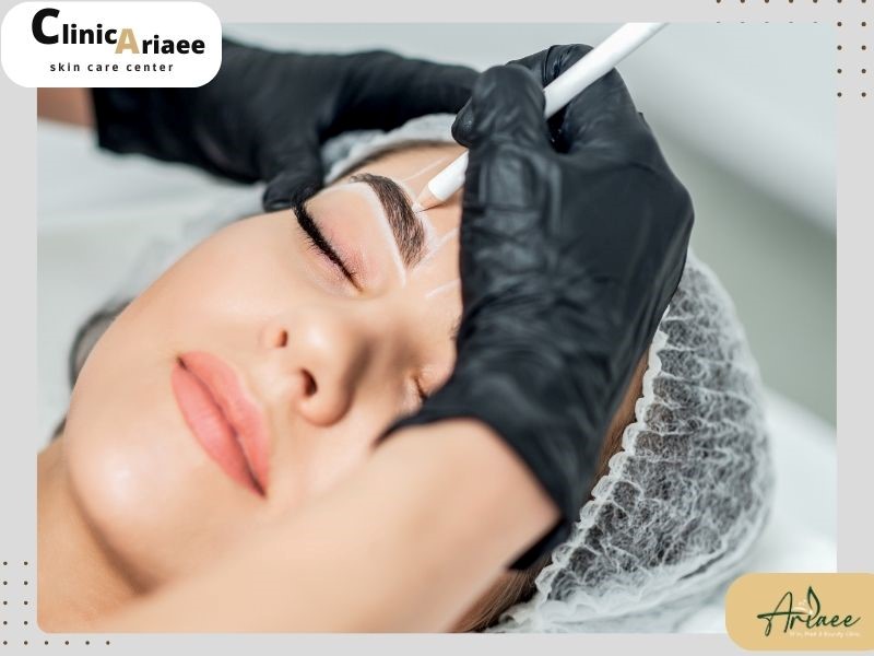 ۵ علت پوست پوست شدن ابرو بعد از کاشت+روش های درمانی مجله سلامت