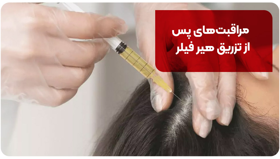 مراقبت‌های پس از تزریق هیر فیلر