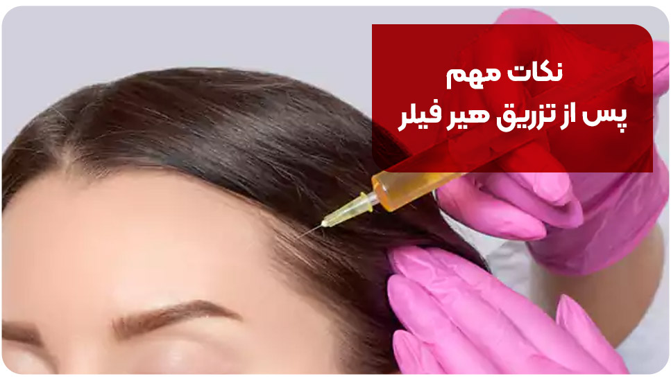 نکات مهم پس از تزریق هیر فیلر